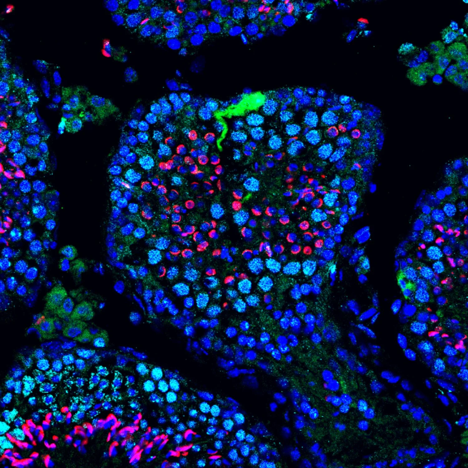 mRNA Therapy Restores Fertility in Genetically Infertile Mice