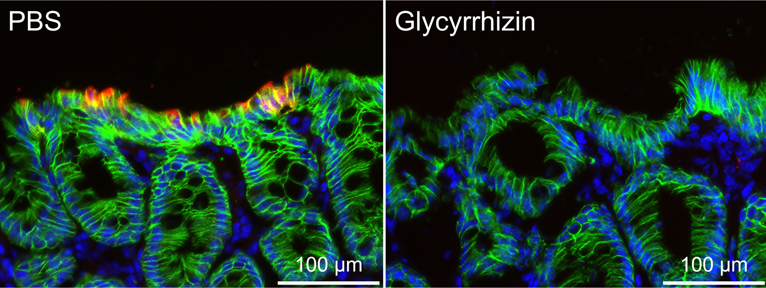 Natural Component from Licorice Alleviates Inflammatory Bowel Disease in Stem Cell-based Model and in Animals