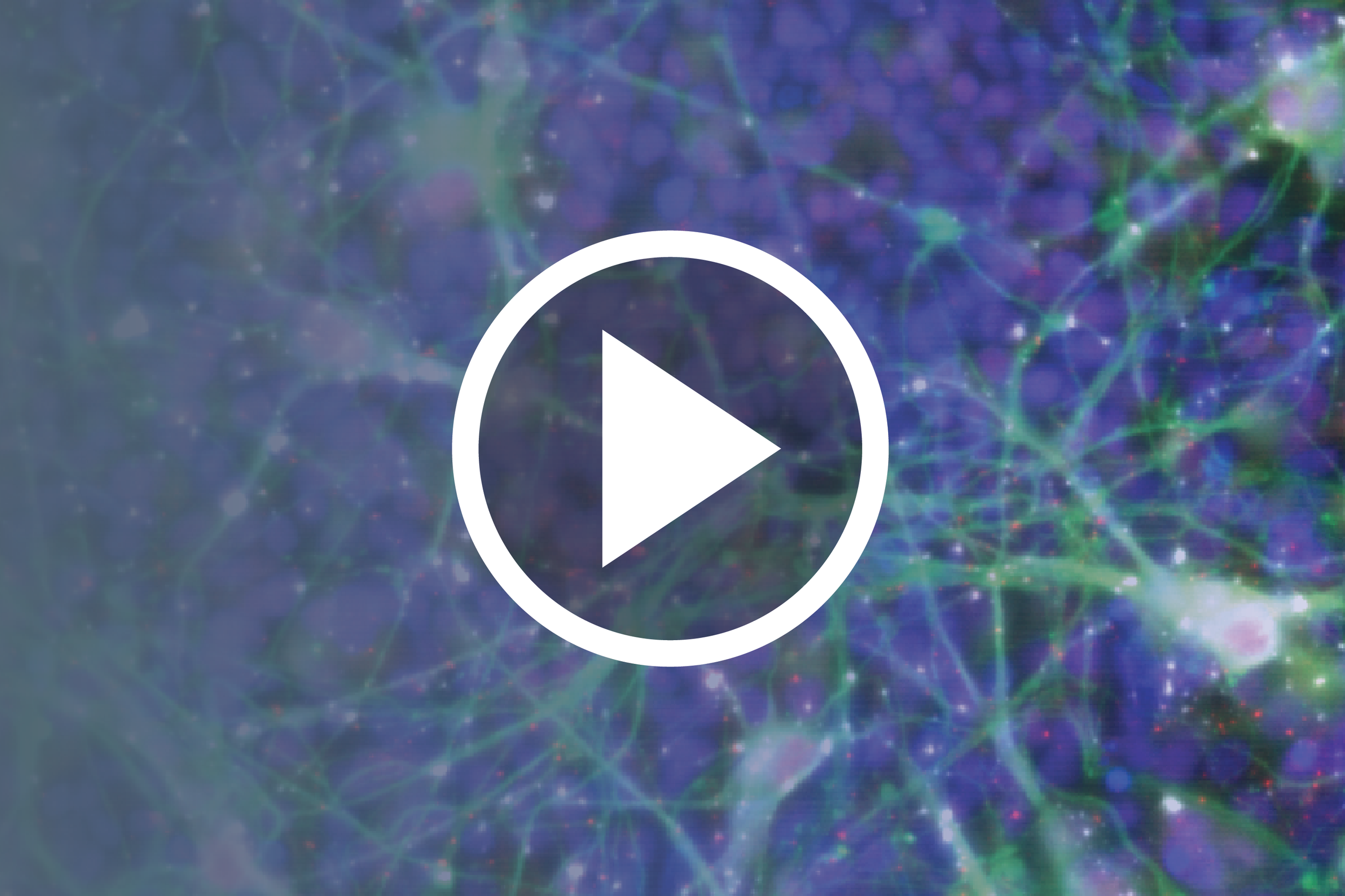 Stem Cells and Parkinson's Disease: Research Advances + Patient Experiences