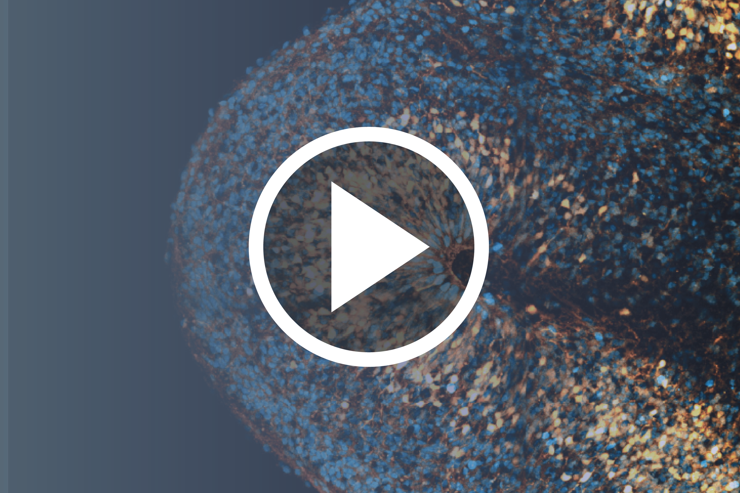 Organoid Models in Development and Disease