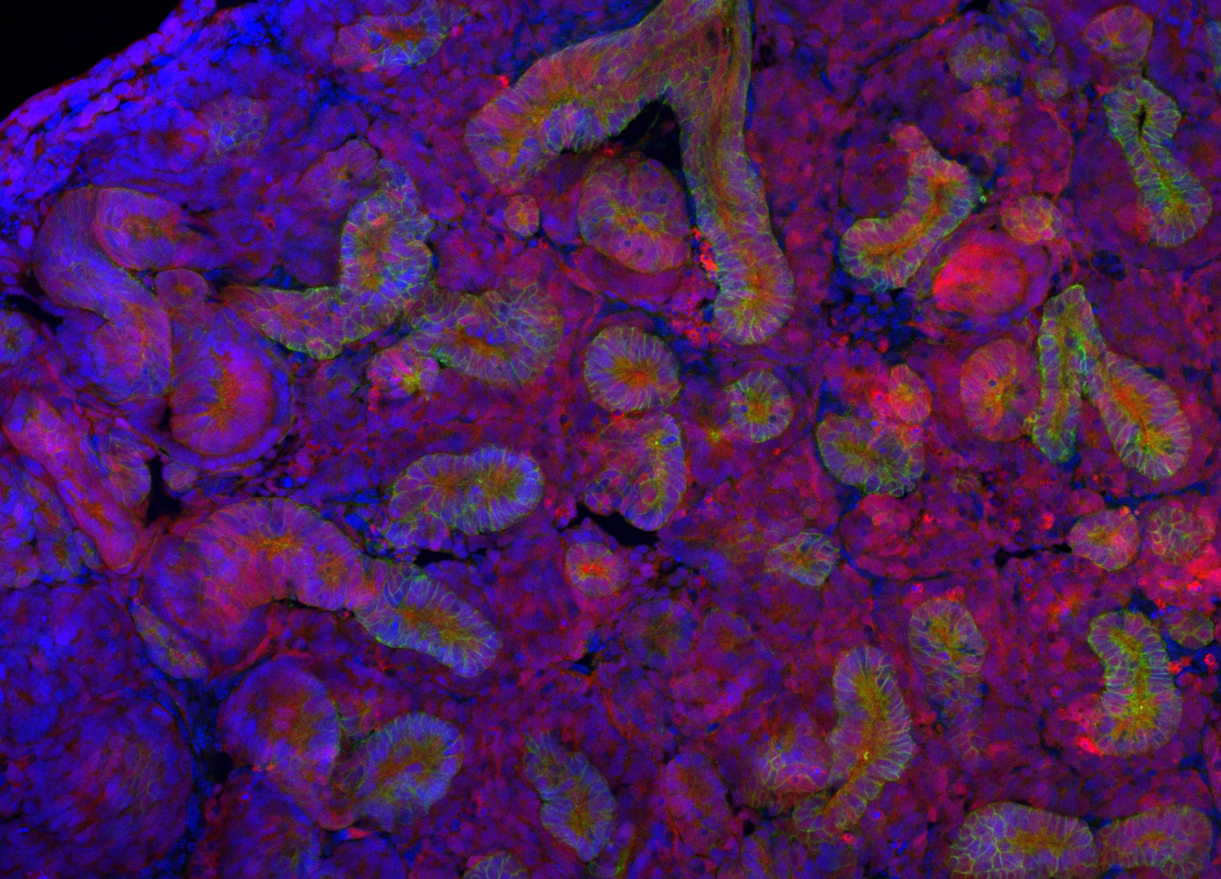 Rat Kidneys Grown in Mice Offer New Insights into Addressing Organ Donor Shortages