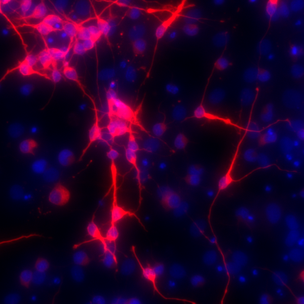 High Fructose During Pregnancy Impairs Stem Cell Function in the&nbsp;Fetal&nbsp;Brain