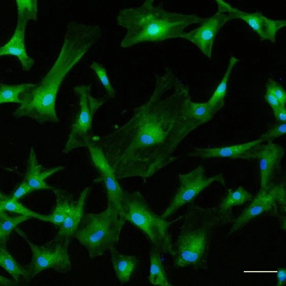 New Study Examines Variable Outcomes of Stem Cell Injections for Knee Osteoarthritis and Strategies to Improve Consistency