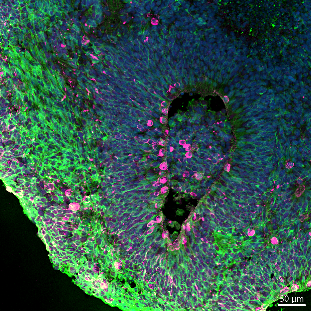 European Summer School on Stem Cell Biology and Regenerative Medicine