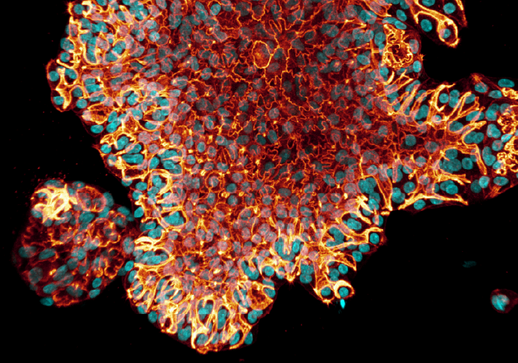 Organoid Models in Tissue Architecture and Patterning