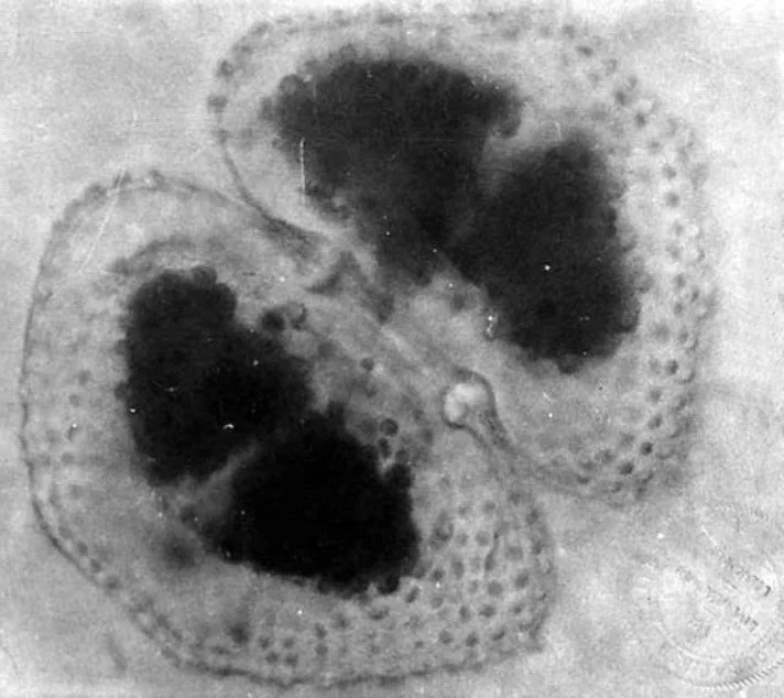 Chlorophyll cell photomicrograph 2, black & white with faint lab stamp in lower left corner.