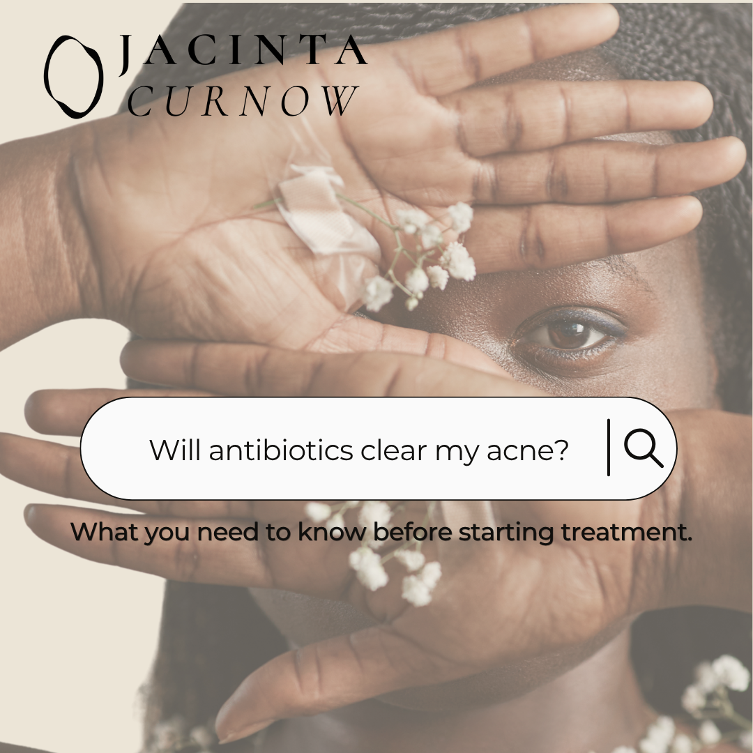 Doxycycline for Acne: What It Does and What It Doesn’t Address