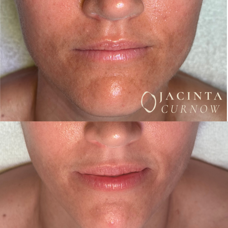 Six Award-Winning Skin Journeys: How Real Clients Achieved Real Results