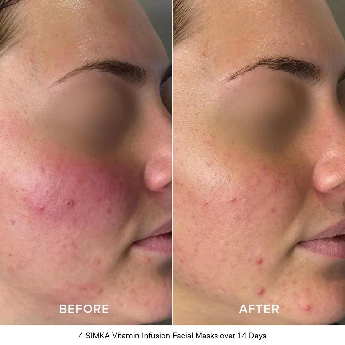 vitamin mask results.webp