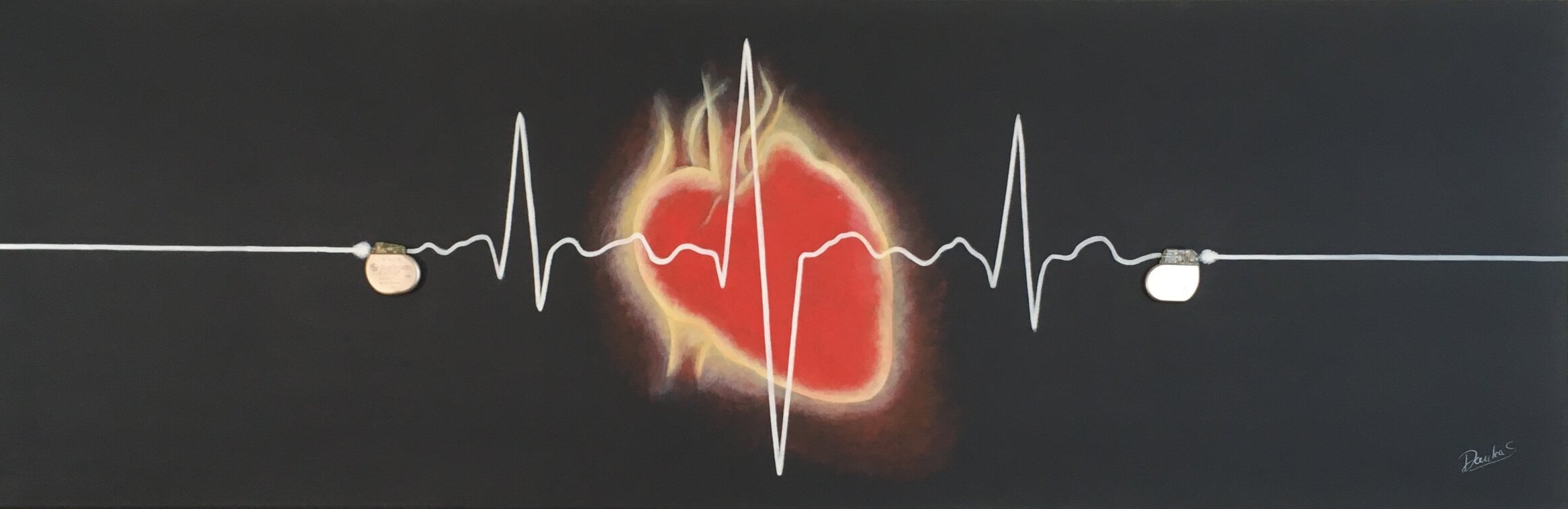 Pacemaker
120x40 Mischtechnik