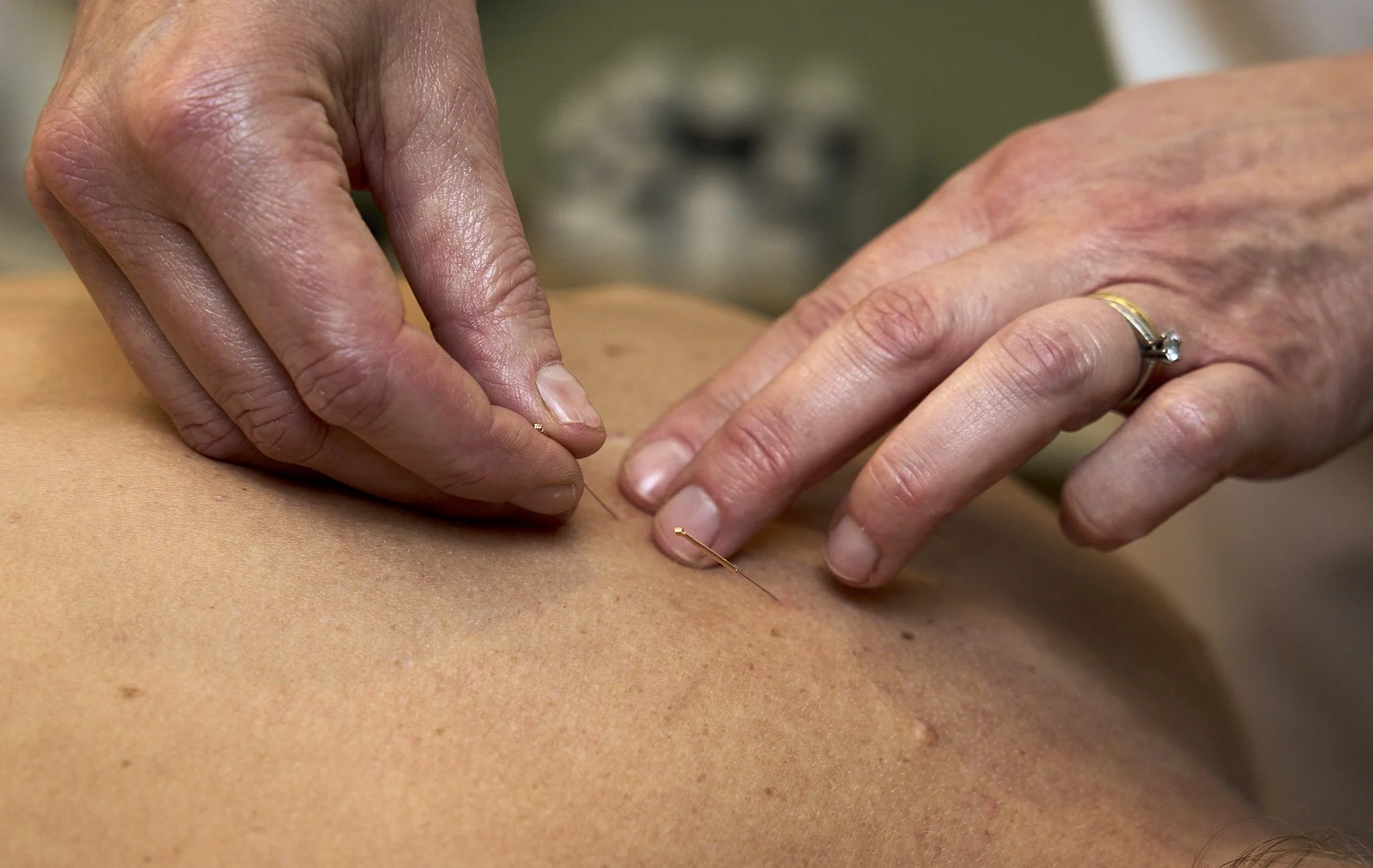 Gezondheidspraktijk-Marieke-Roossen-acupunctuur-massage-zwangerschapsmassage-Gezonde-Leefstijl-vrouwen-Iris-Koopmans-Fotografie 15.jpg