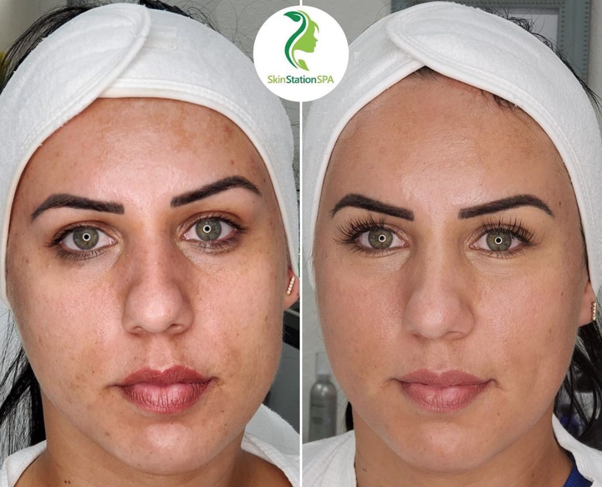 Signature Facial Cleansing