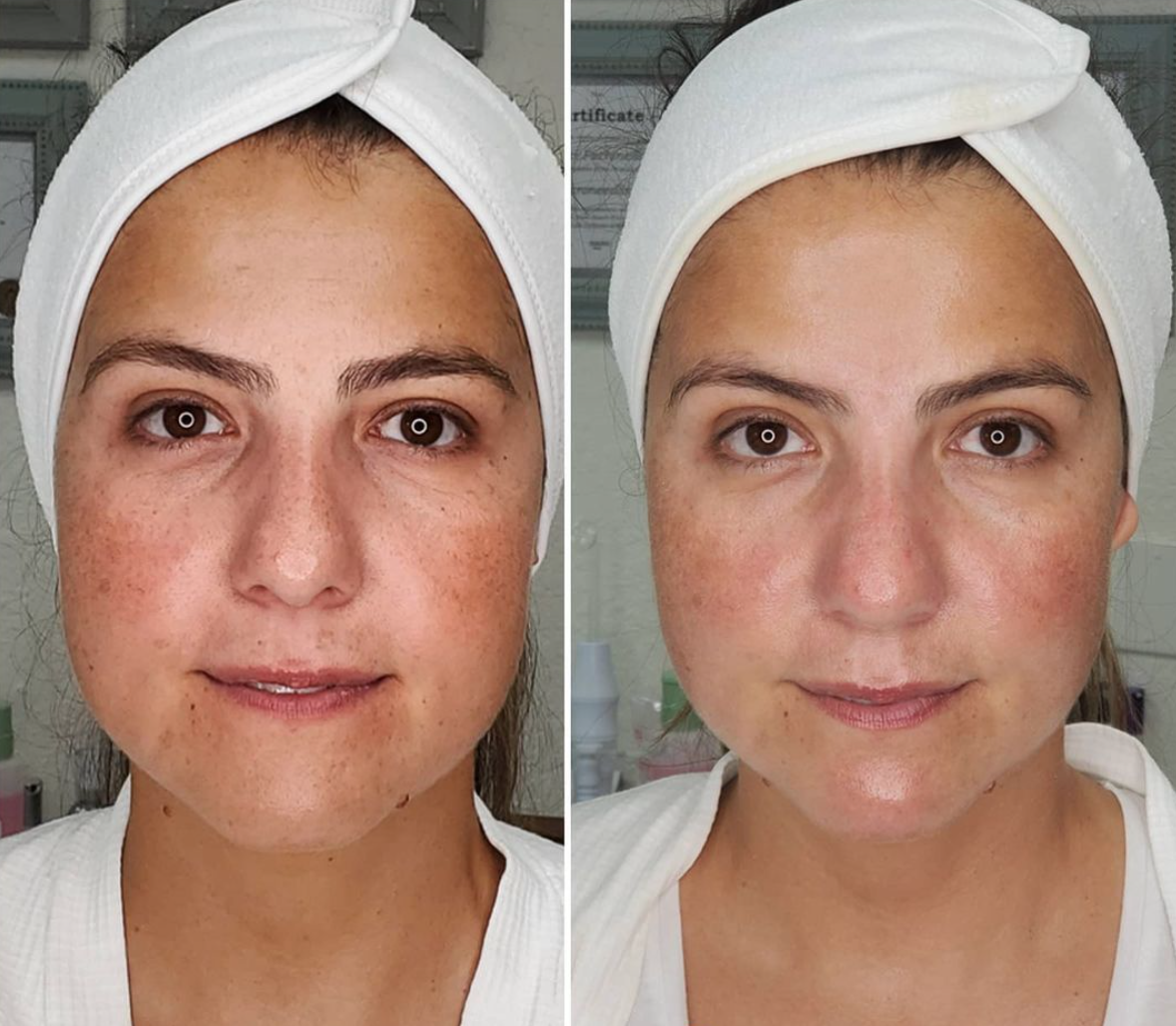 Signature Facial Cleansing