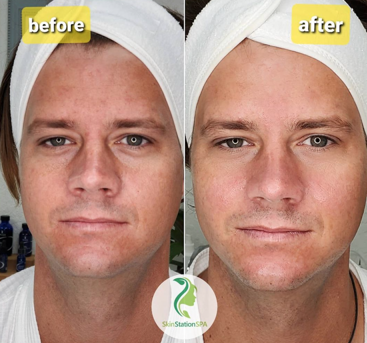 Signature Facial Cleansing