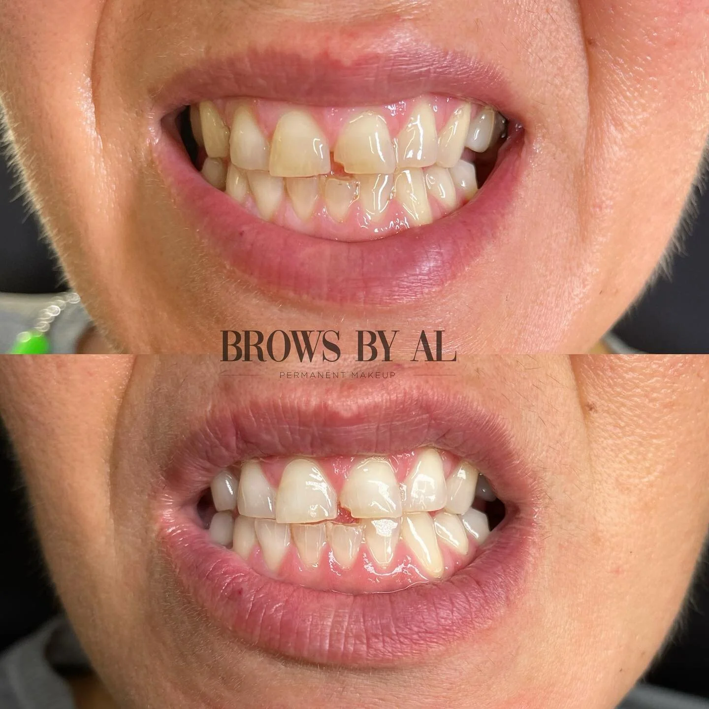 𝐓𝐄𝐄𝐓𝐇 𝐖𝐇𝐈𝐓𝐄𝐍𝐈𝐍𝐆 𝐃𝐄𝐀𝐋🦷✨✨book a 1 hour treatment for ONLY $99‼️
Results➡️1-7 shades brighter!
Results every time!
&mdash;&mdash;&mdash;&mdash;&mdash;&mdash;&mdash;&mdash;&mdash;&mdash;&mdash;&mdash;&mdash;&mdash;&mdash;&mdash;&mdash;