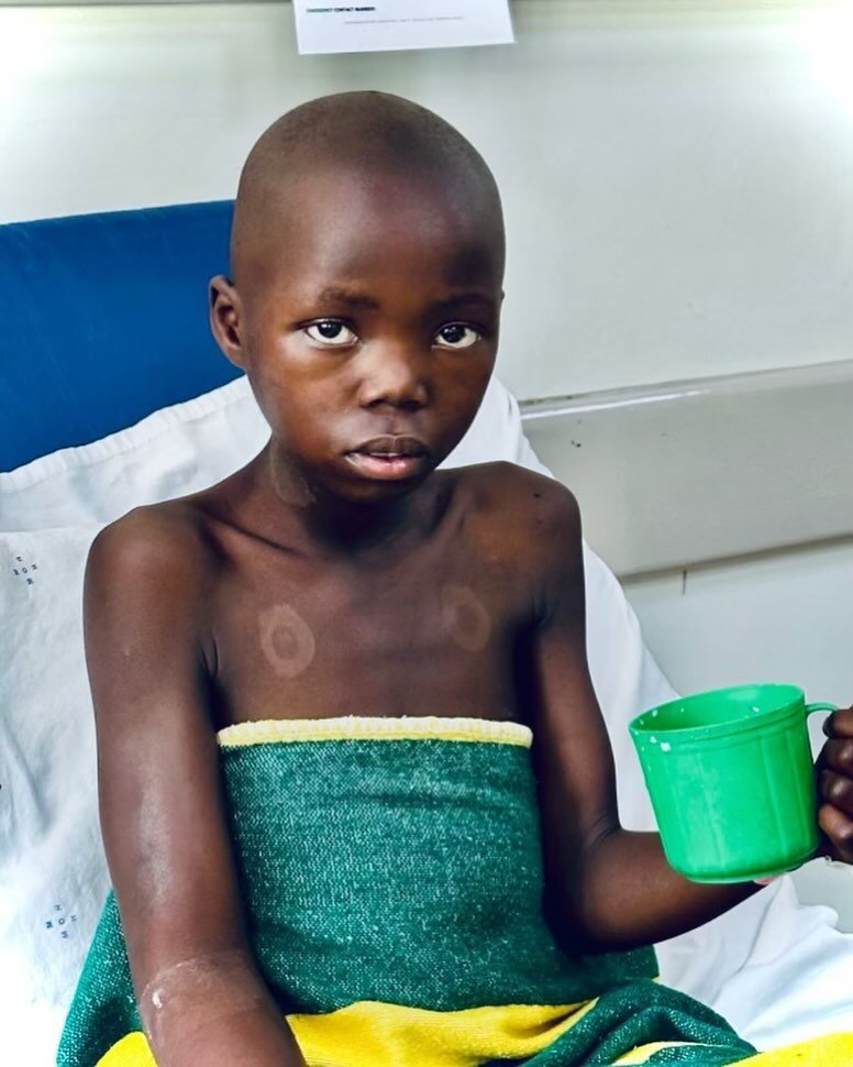 This is Leticia.  She is 12 years old and from Machinjiri in Blantyre. Leticia&rsquo;s family brought her to the Mercy James Centre with unbearable stomach pain. She was diagnosed with a Wilms tumor, affecting her liver and lungs. Through weekly chem