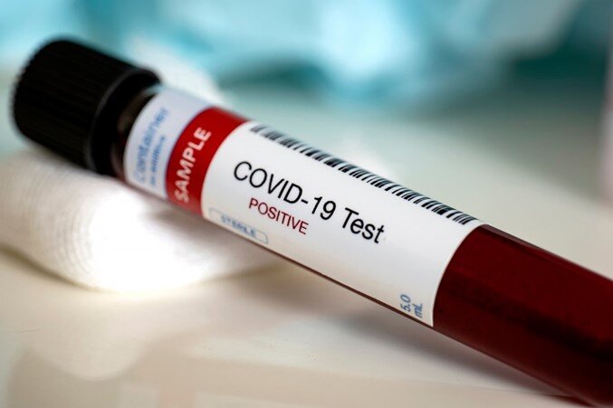 Responding to an Employee's Positive Coronavirus Test