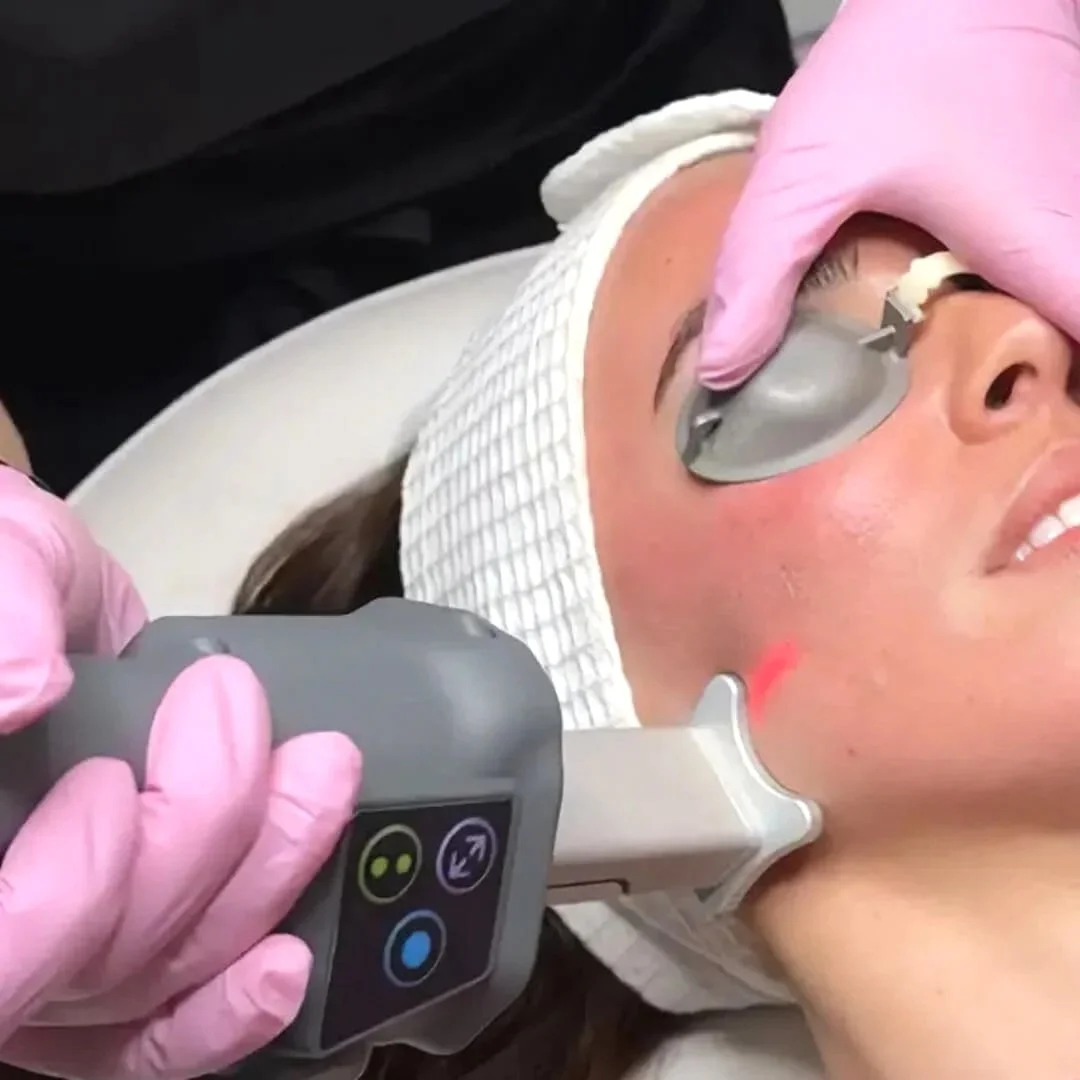 About Faces Med Spa Helix Laser