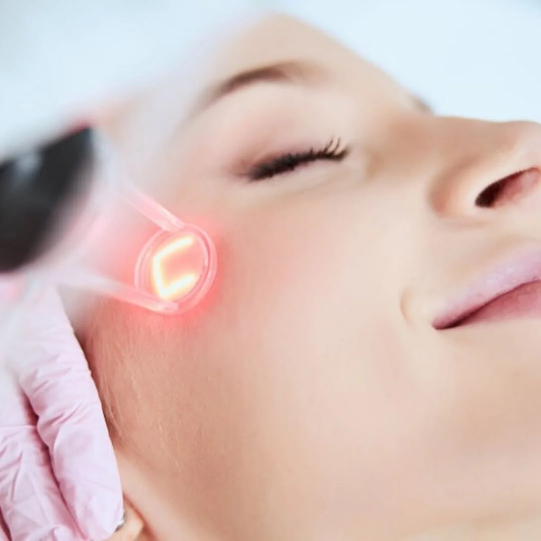 Close up of CoolPeel Laser Treatment