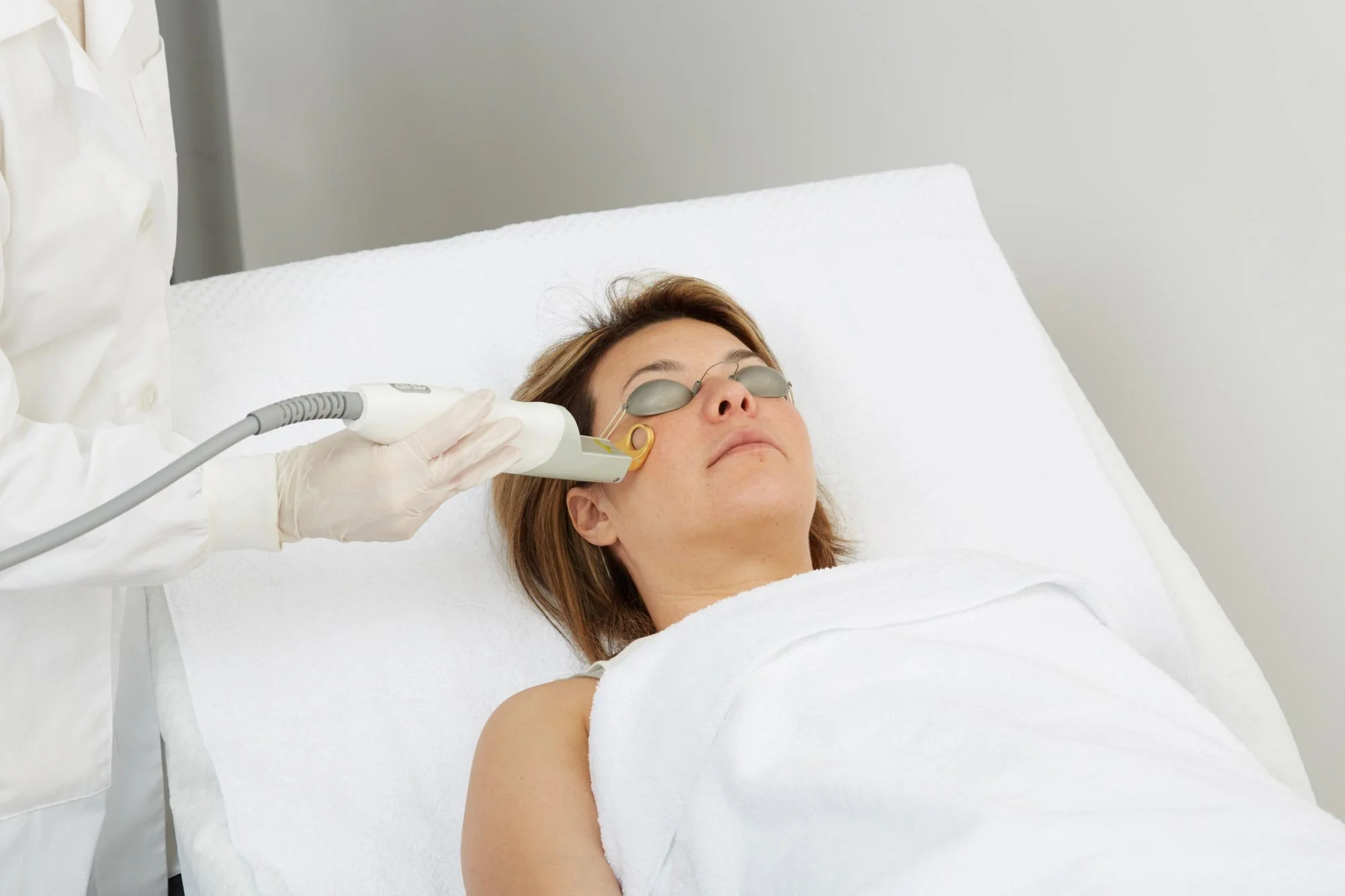 Woman receiving treatment with Cutera Excel V+ Laser on her face.