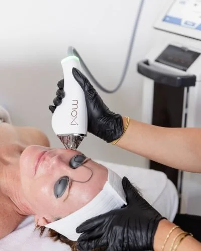 Patient at Gold Coast Dermatology Clinic receiving a Sciton MOXI treatment on her face in clinic.