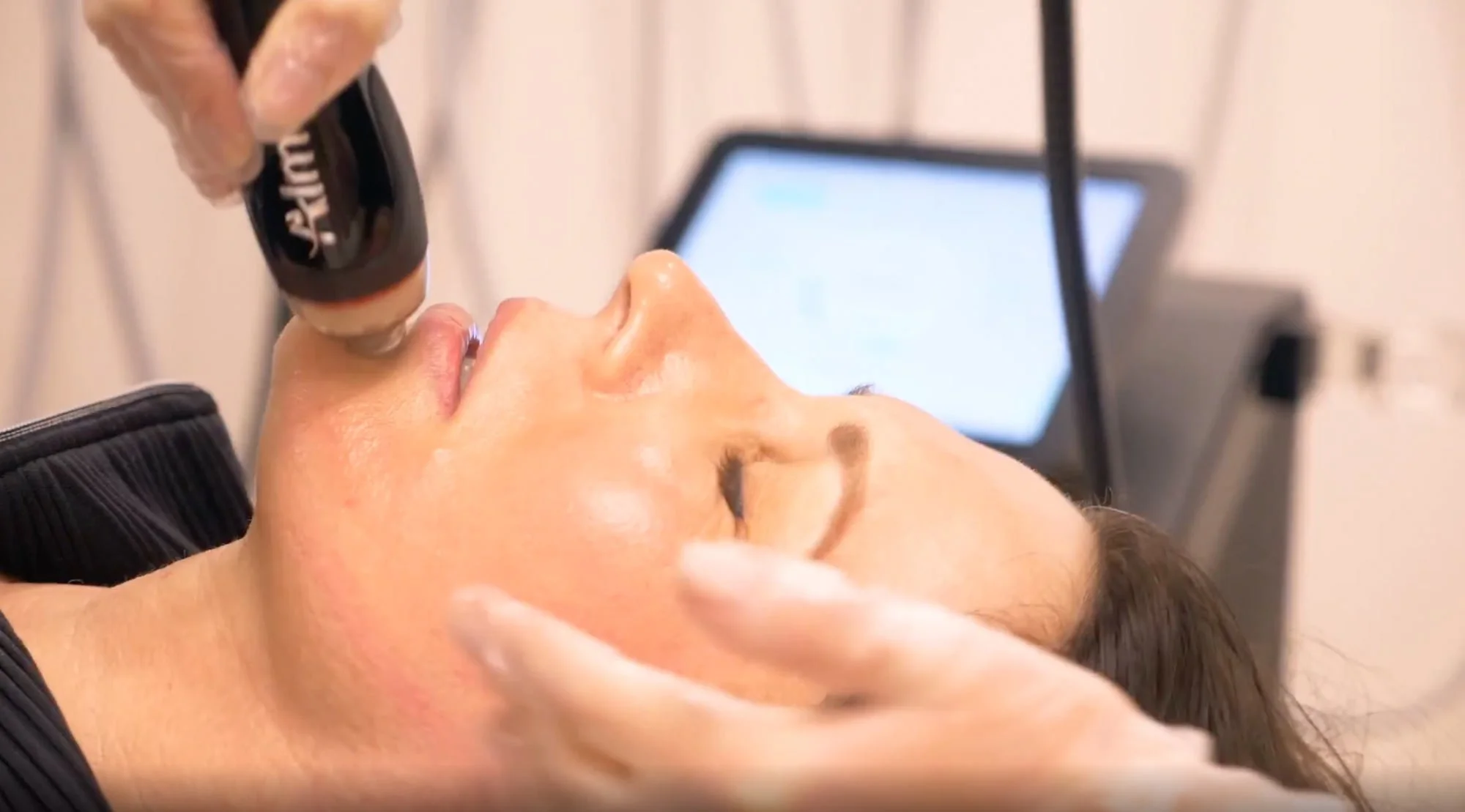 Patient at Gold Coast Dermatology Clinic receiving an Alma DermaClear treatment on her face in clinic.