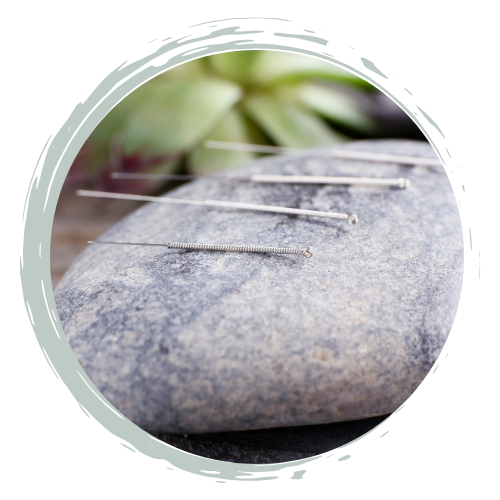 Acupuncture_vs_dry_needling