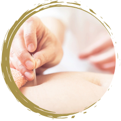 Acupuncture_For_PCOS