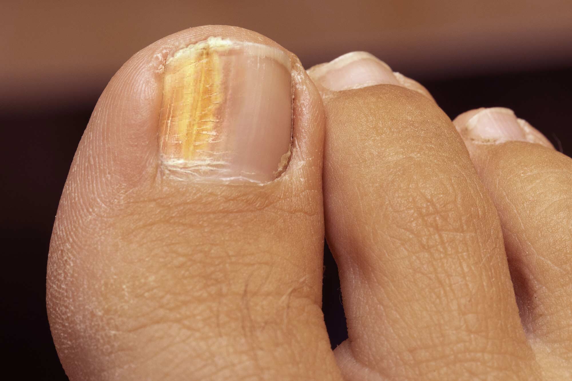 16 Disturbing Things Your Nails Reveal About Your Health - Facty Health