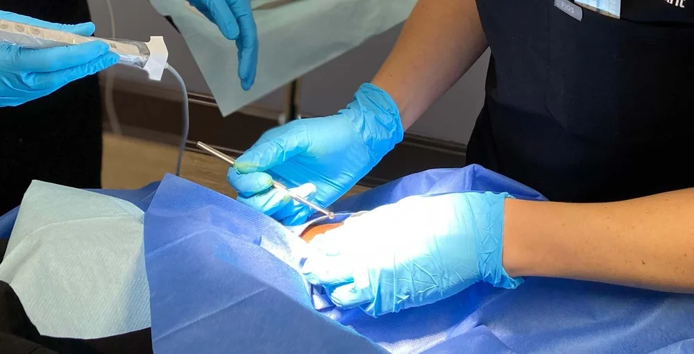 Electrodessication & Curettage — Fora Dermatology General & Surgical