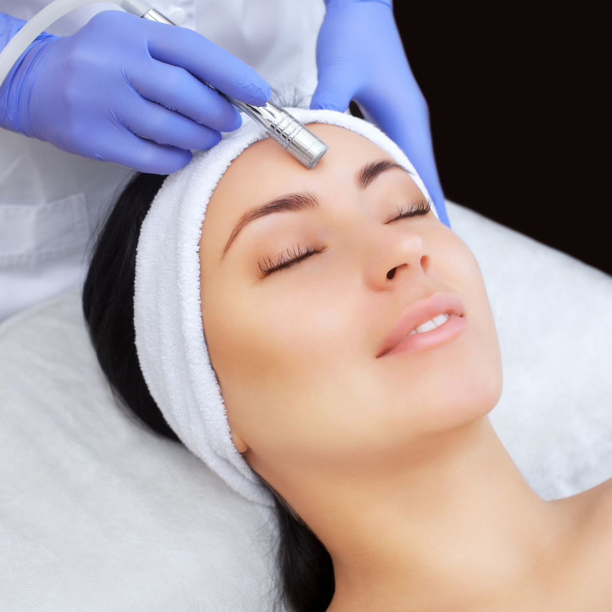 Microdermabrasion