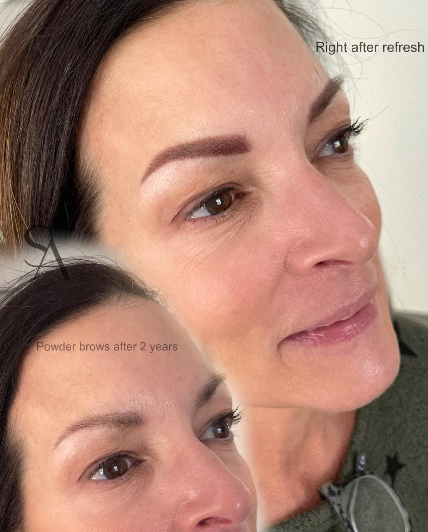 So many great cases that I&rsquo;m not posting cause I&rsquo;ll be lazy at the moment and then they disappear in the abyss of my camera roll😂
Sometimes my phone reminds me! So here&rsquo;s a beautiful lady with her brows before and after the refresh