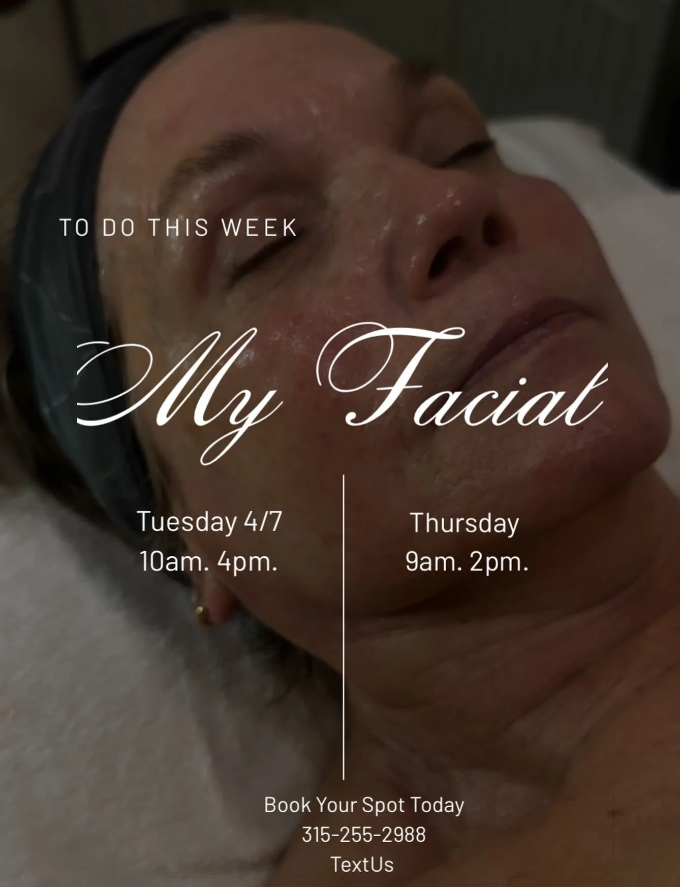 Did you add your skincare regimen to your to - do list this week? 🫶

315-255-2988 __secure your appointment with @the.esti.lexie 

&ldquo;Her hands were magic&rdquo; 
🧖&zwj;♀️