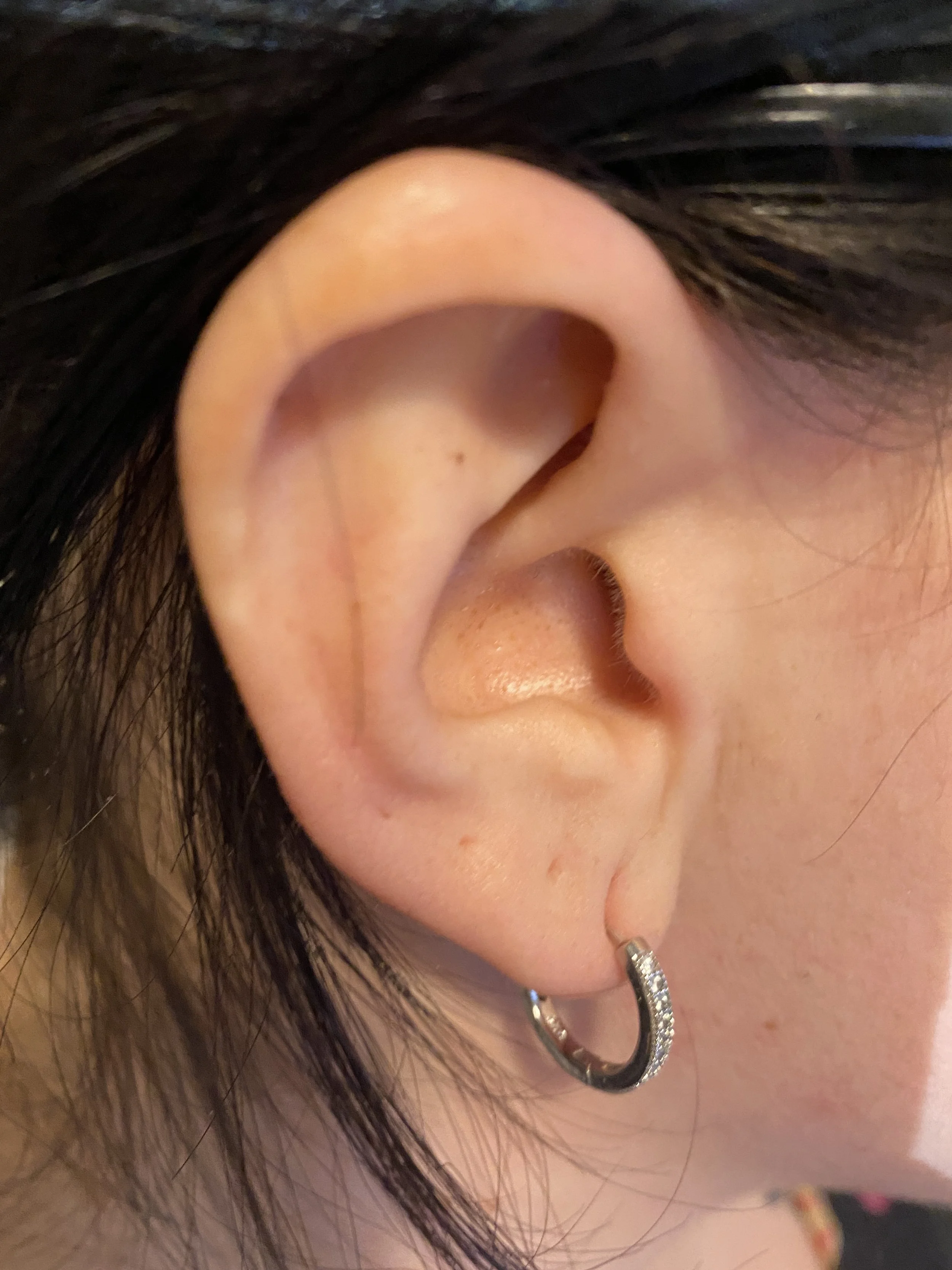 Ear Wax Removal Services Across Suffolk Ear View