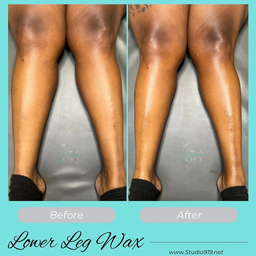 Shin So Smooth , It Deserves It&rsquo;s Own Spotlight 😮&zwj;💨🔥
🔗
🔗
#exfoliate #exfoliating #waxing #804wax #rvawax #rvawaxer #rvawaxing #rvabrows #rvabrazilianwax #rvabikiniwax #brazilianwax #brazilianwaxspecialist #bikiniwax #waxyourkitty #waxi