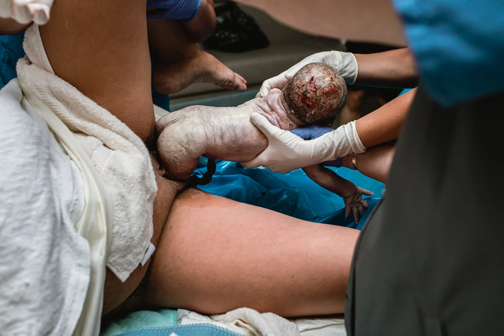 fort worth birth photographer | LC Birth Stories | birth gallery.jpg