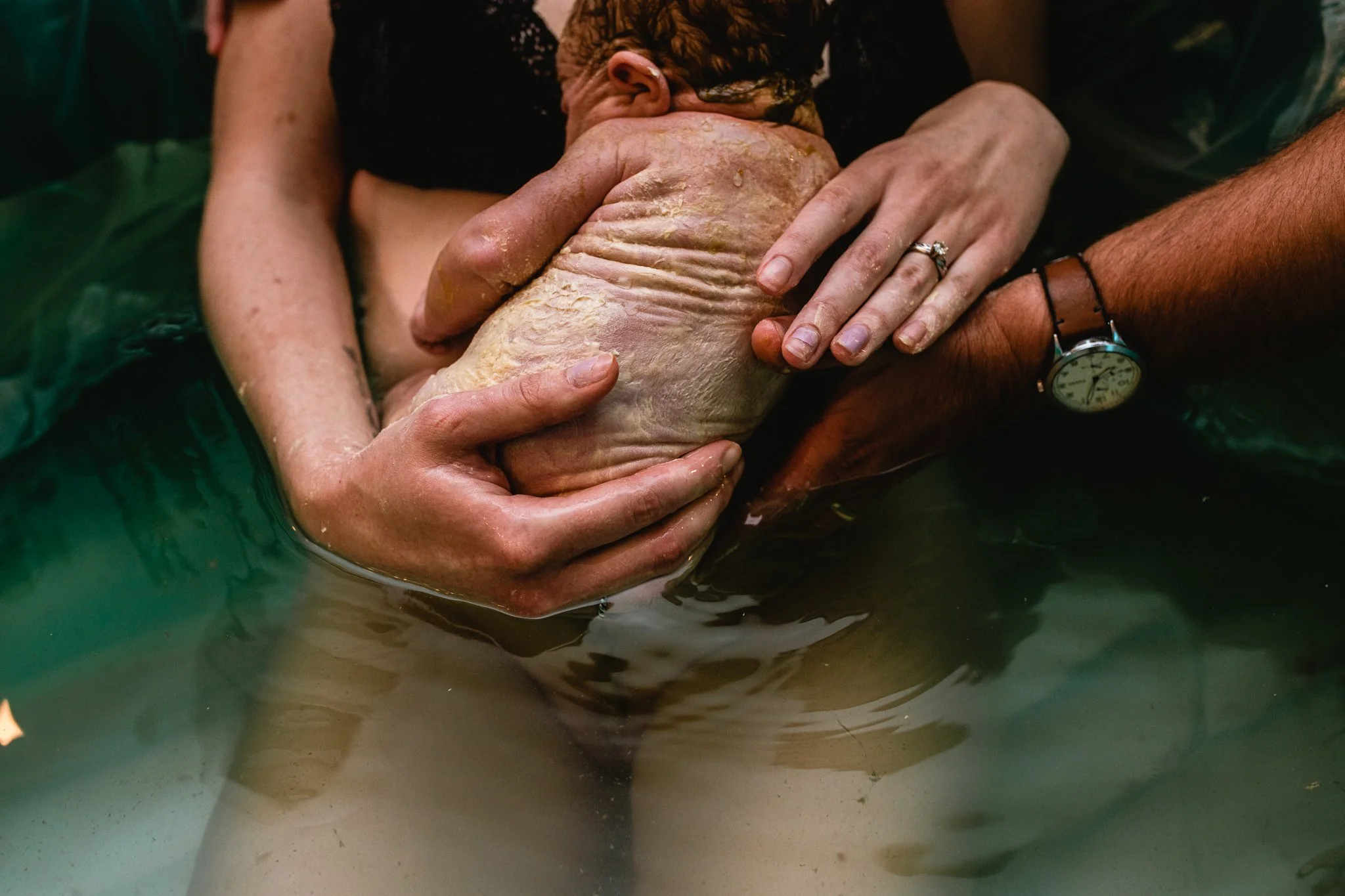 birth photographer dfw | LC Birth Stories | birth gallery.jpg