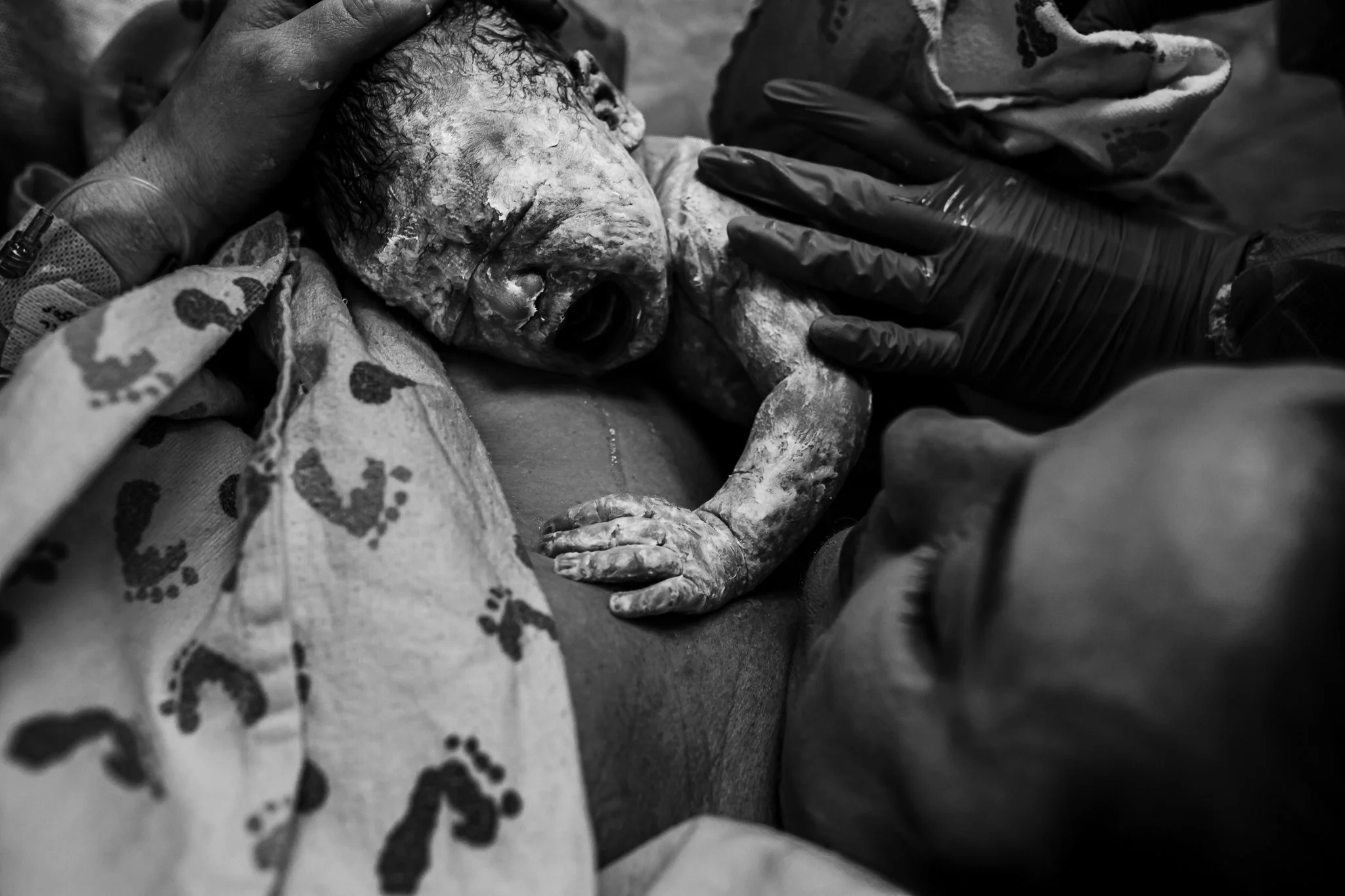 Birth Photography | C-Section | Lc Birth Stories.jpg