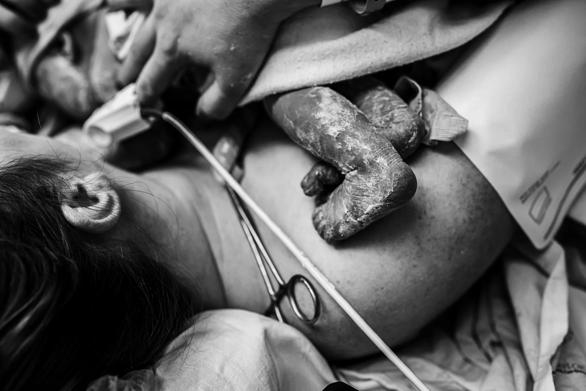 LC Birth Stories | Cesarean Birth.jpg