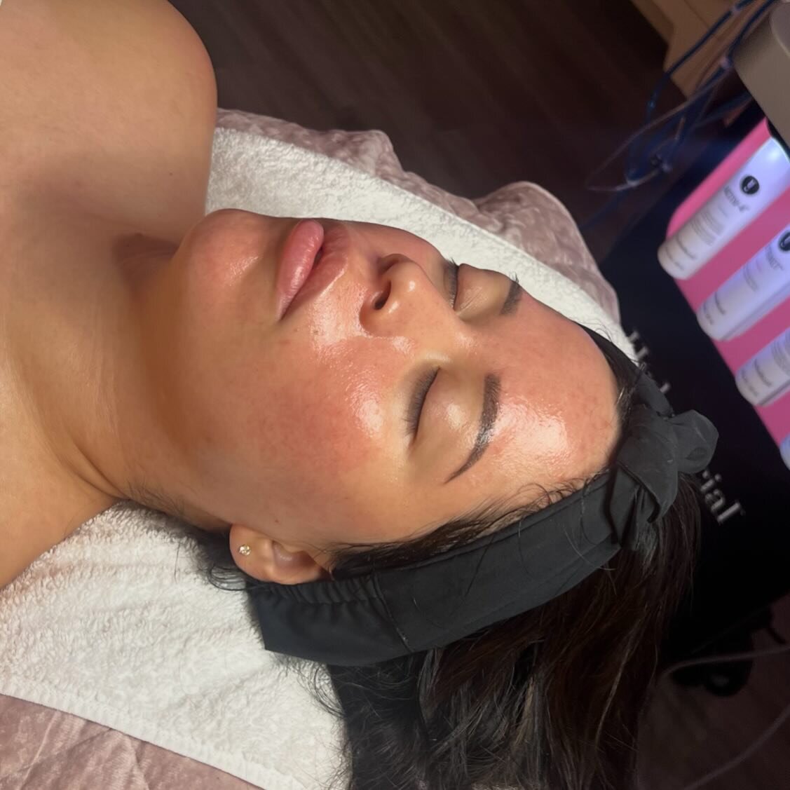 🫰🏼🪄HydraFacial Glow 

🔗Link in bio to reserve a spot
📲text 309.573.1406 

&bull;
&bull;
&bull;

#Hydrafacial #Facial #healthyskin #selfcare #clearskin #medicalgradeskincare #results #luxeaestheticsstudio