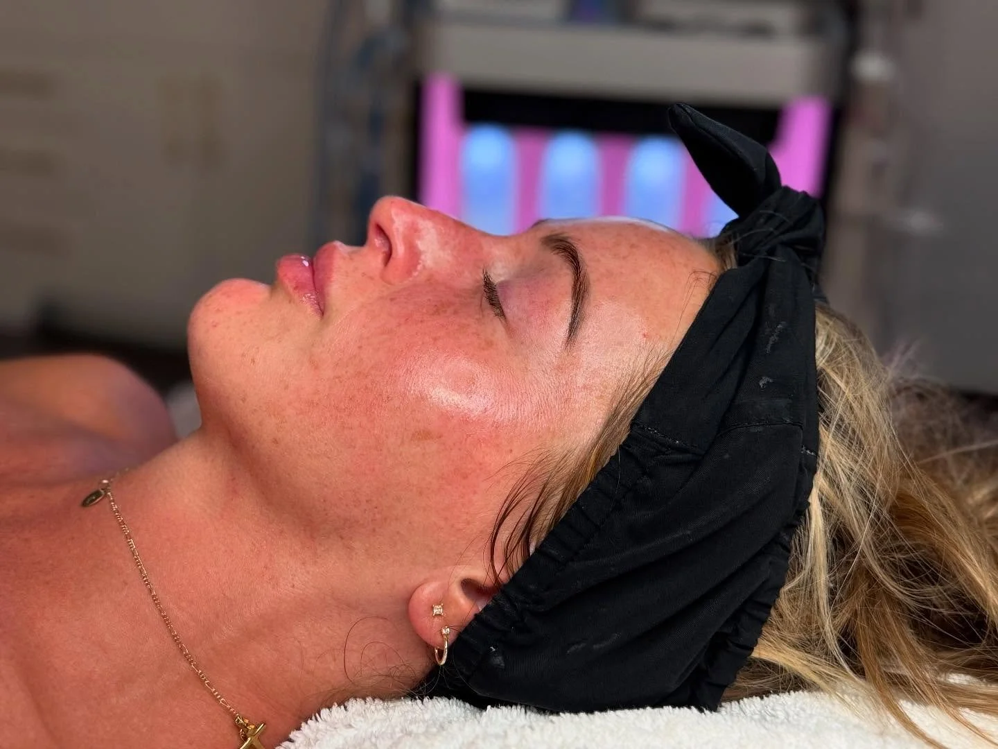 𝙛𝙚𝙬𝙚𝙧 𝙬𝙧𝙞𝙣𝙠𝙡𝙚𝙨 &bull; 𝙛𝙞𝙧𝙢𝙚𝙧 𝙨𝙠𝙞𝙣 &bull; 𝙞𝙣𝙨𝙩𝙖𝙣𝙩 𝙜𝙡𝙤𝙬 ♡ ✨

#hydrafacial #glassskin #facial #skincare #spa #peoriailaesthetician