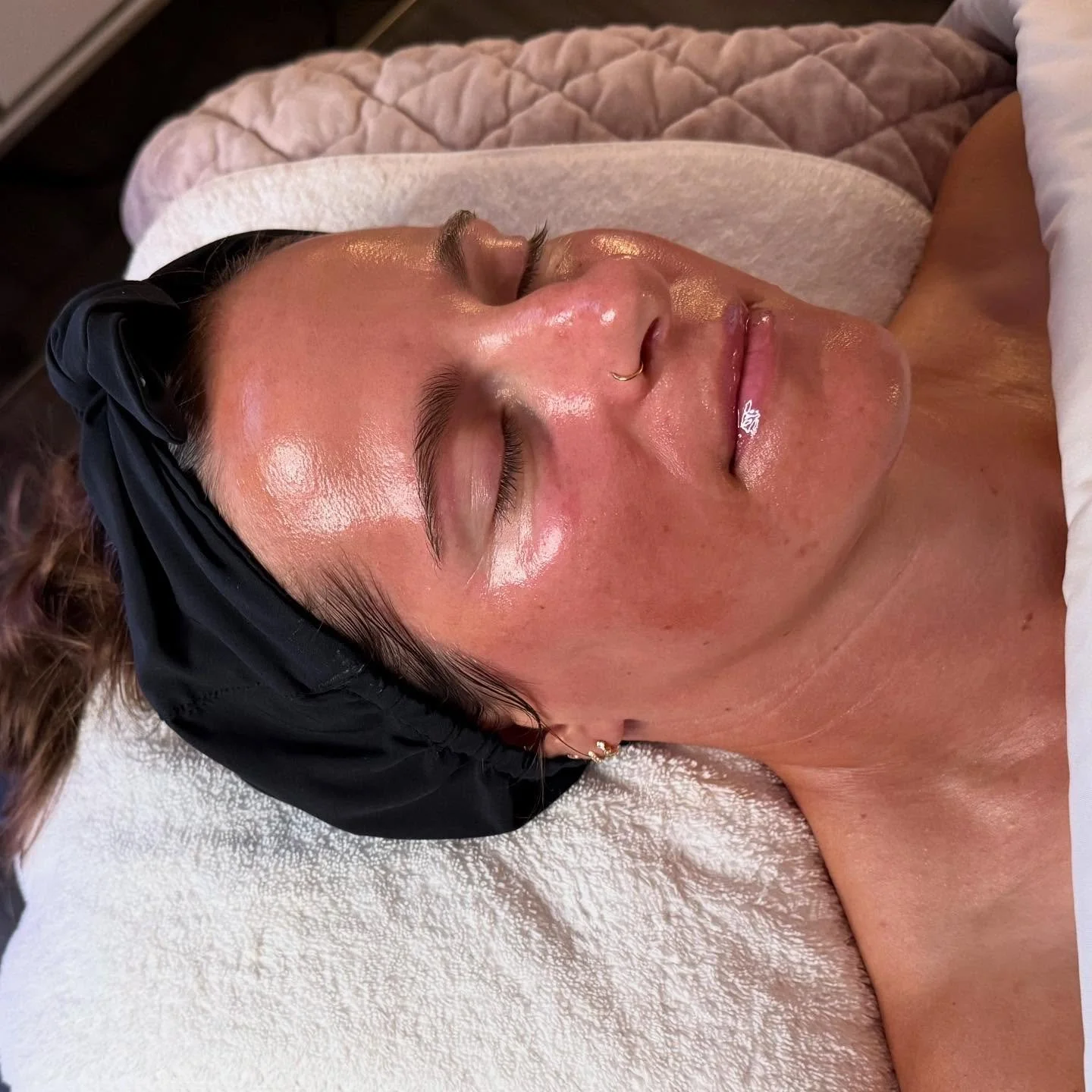 The Hydrafacial &ldquo;Glass Skin&rdquo; Facial is a treatment that combines the technology of a traditional Hydrafacial with boosters to achieve the ultra-smooth, poreless, and glass look. 🪄✨

Here&rsquo;s what it usually involves:

✨ Deep cleansin