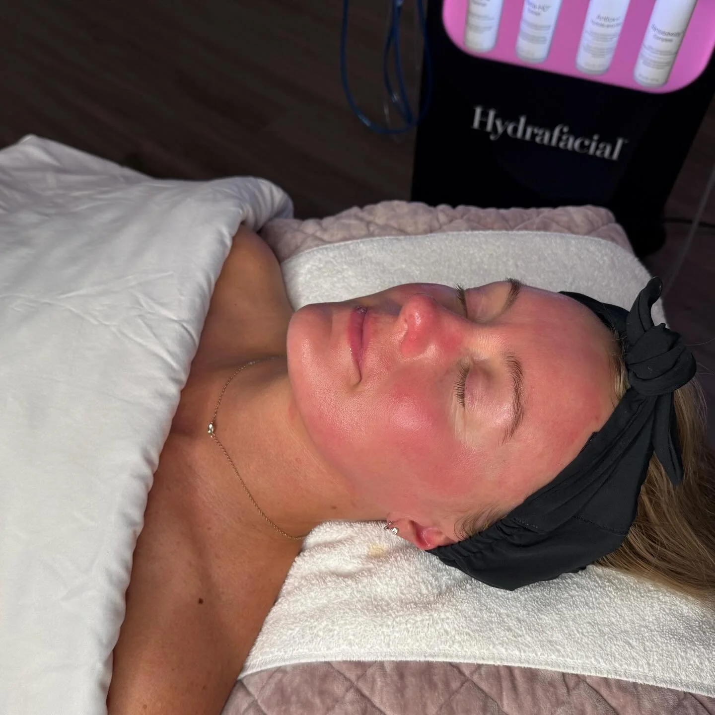 Hydrafacial is the glow up treatment we loveeee 💞✨

#hydrafaci̇al #healthyskin #skincareroutine #selfcare #peoriailspa