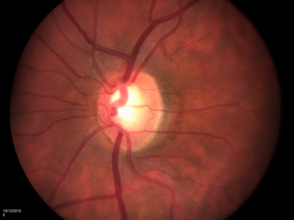 comprehensive-eyecare-shoreline-eye-group