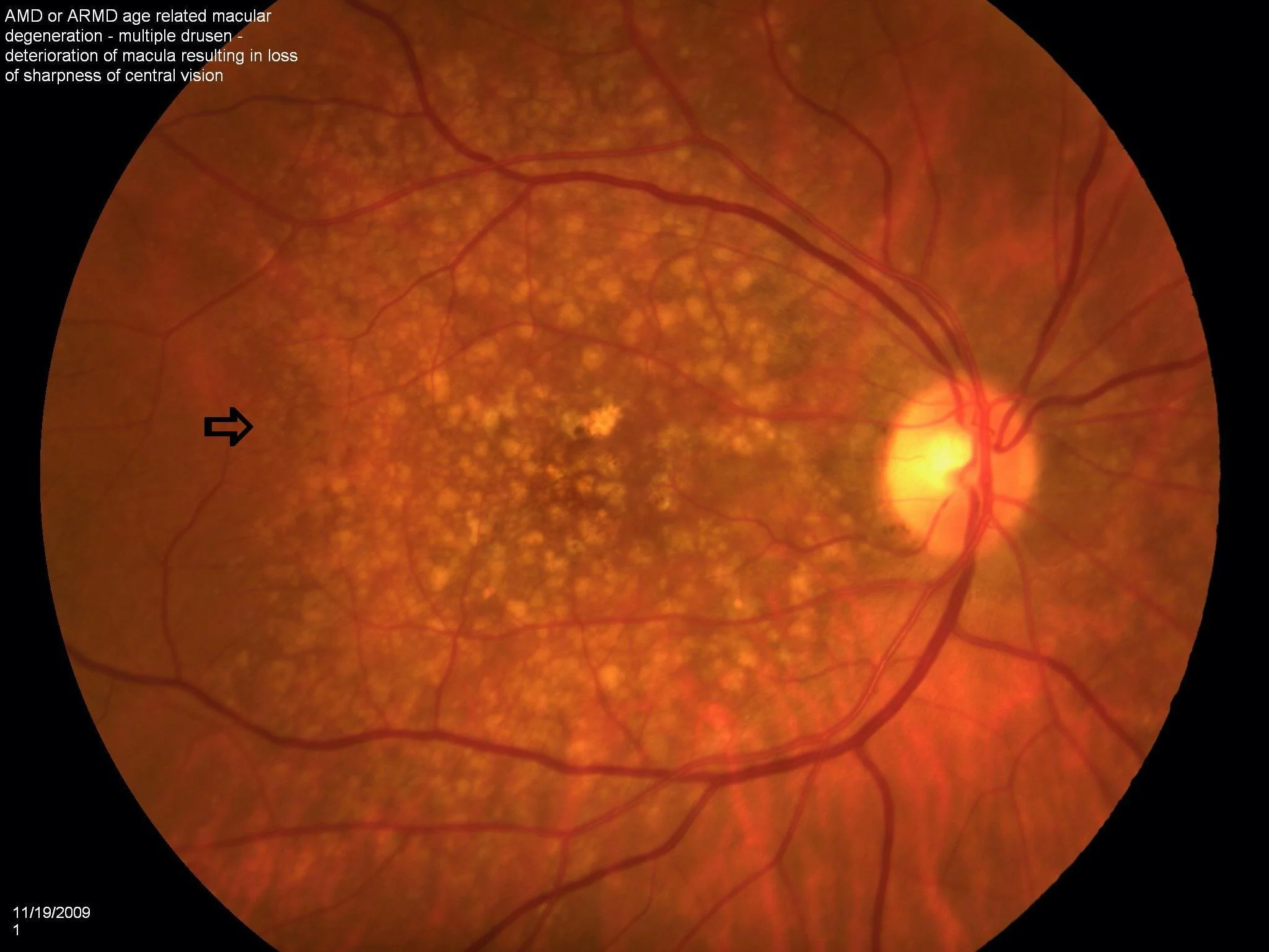 comprehensive-eyecare-shoreline-eye-group
