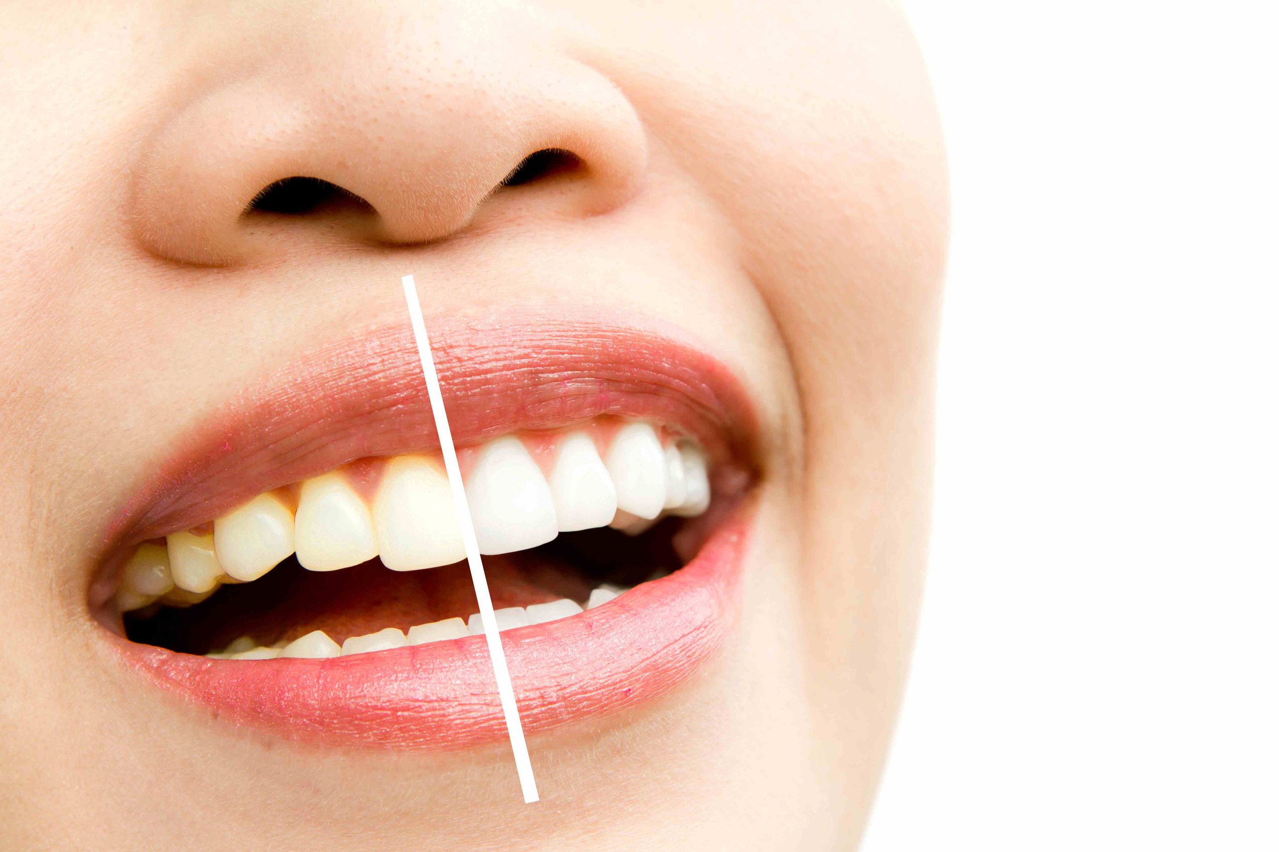 Dentist Auckland Central, West, South, North Shore Auckland Family Dental