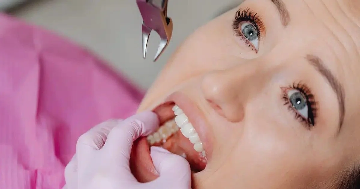 Tooth Extraction for Dental Implants: Preparing Your Jaw for a New Smile
