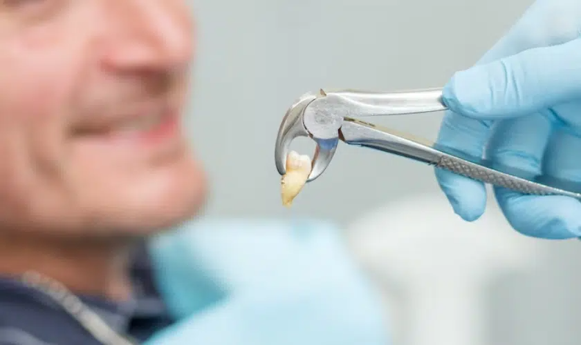 Wisdom Tooth Extraction Aftercare: Dos and Don’ts