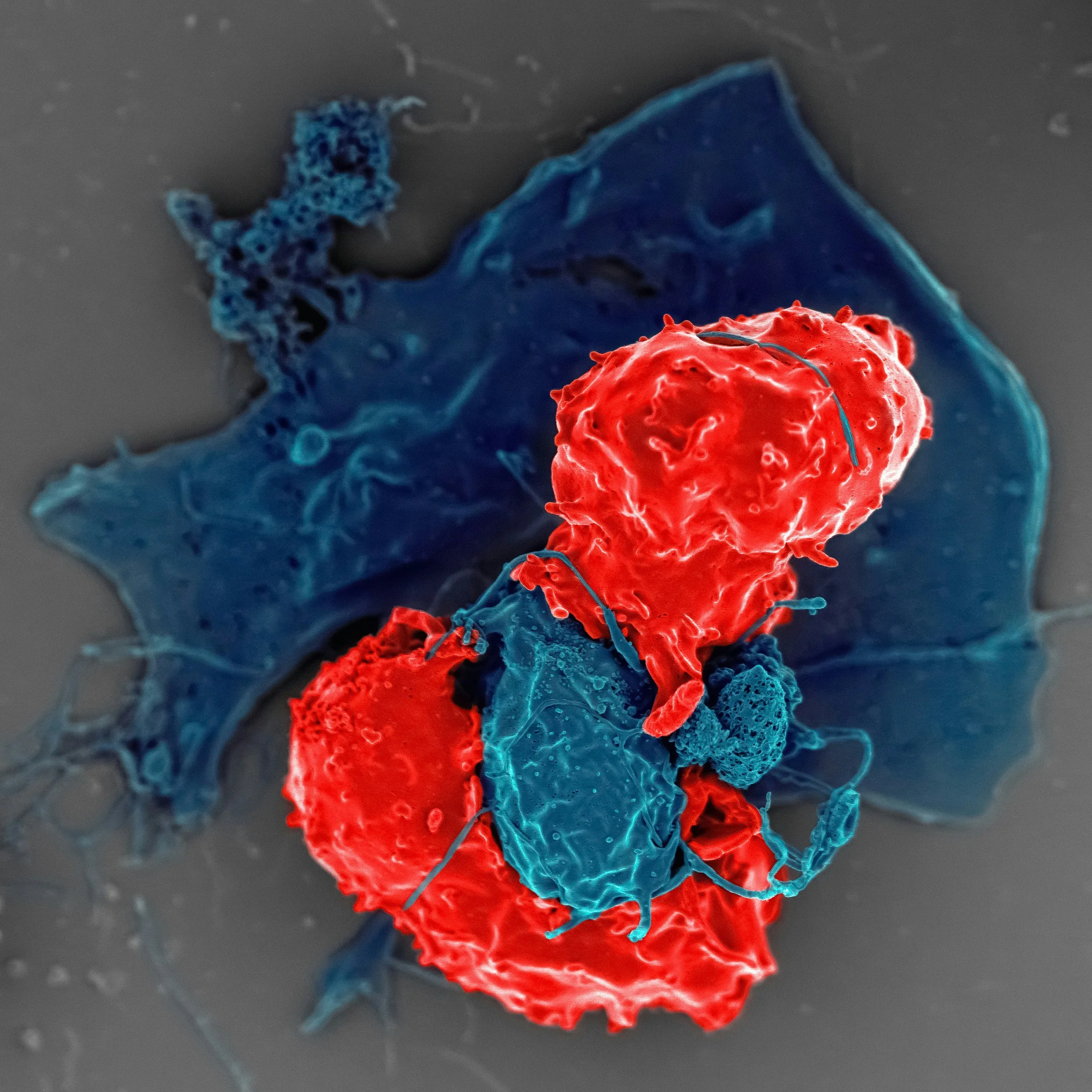Recharging the “Immune Battery” in Heart Failure&nbsp;