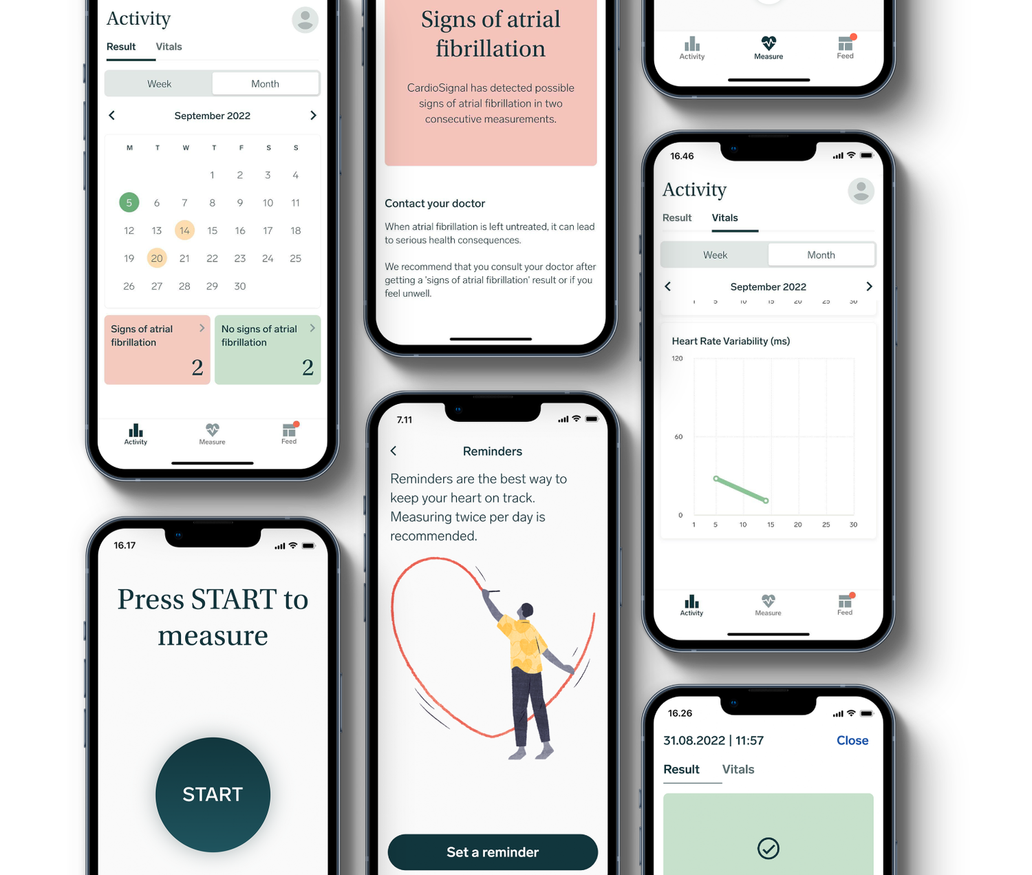 How it works — CardioSignal